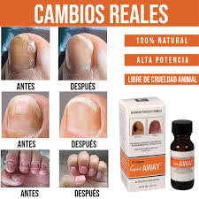 Reparador de uñas